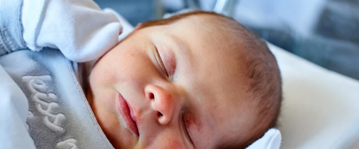 آیا فتوتراپی به چشم و پوست نوزاد آسیب می زند؟